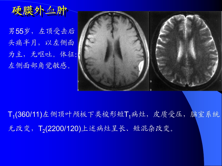 10MRI图像脑1文档资料.ppt_第2页