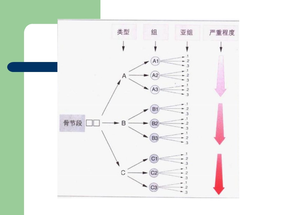 最新骨折分型ppt课件PPT文档.ppt_第2页