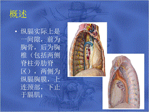 原发性纵膈肿瘤ppt课件文档资料.ppt