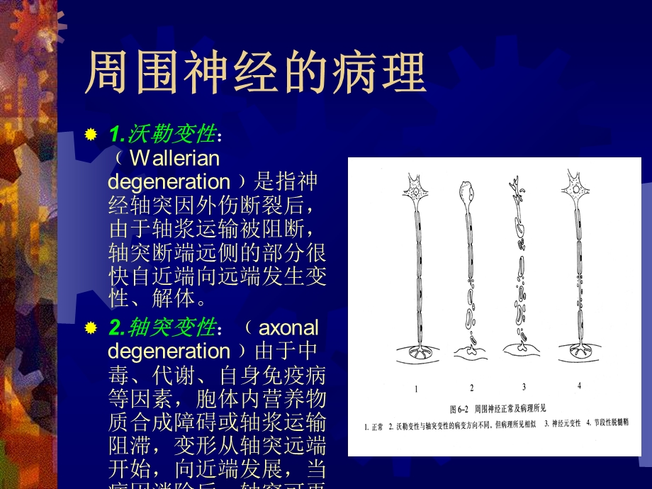 周围神经病吉大二院精选文档.ppt_第3页