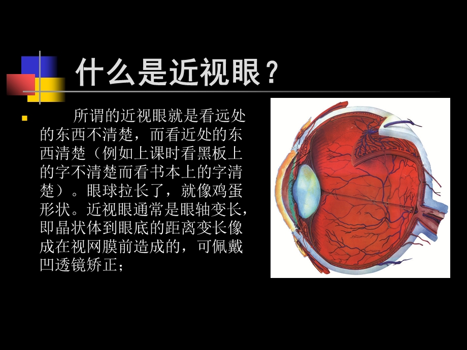 中学眼保健专业课件PPT文档.ppt_第3页