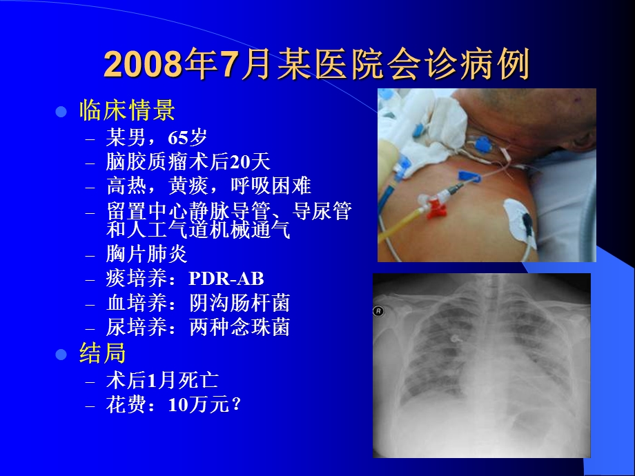 医院感染管理与控制PPT文档.ppt_第3页