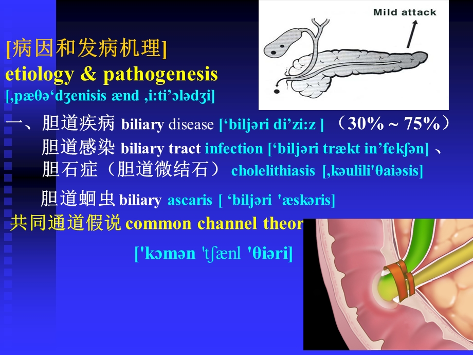 10急性胰腺炎PPT文档.ppt_第3页