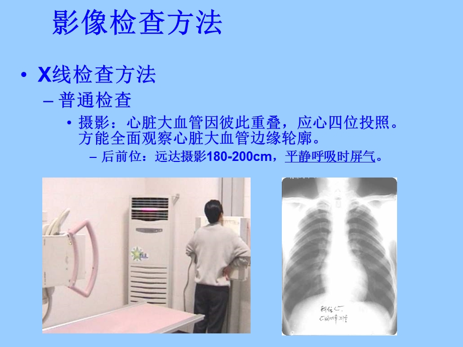 心与大血管读片方法及常见病的X线诊断PPT文档.ppt_第3页