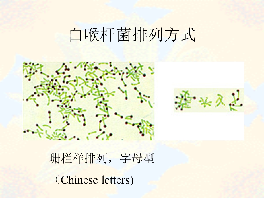 白喉杆菌Cdiphtheria白喉名师编辑PPT课件.ppt_第3页