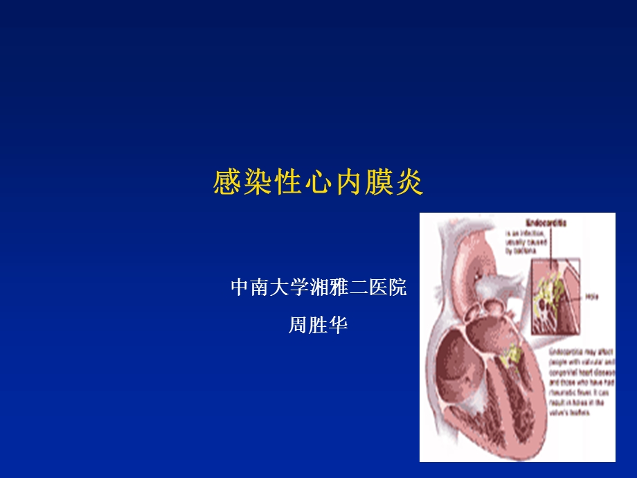 感染心内膜炎名师编辑PPT课件.ppt_第1页