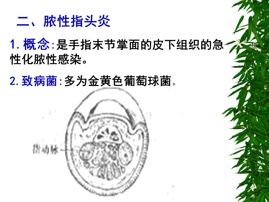 手部急性化脓性感染名师编辑PPT课件.ppt_第3页