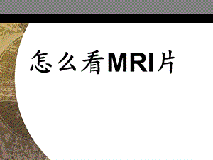 爱爱医资源爱爱医资源爱爱医资源怎么看MRI片名师编辑PPT课件.ppt