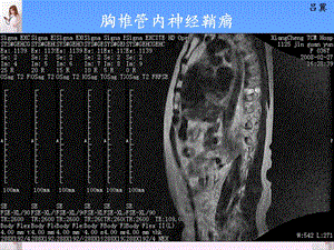 医影在线CNS疾病MRI诊断精选文档.ppt