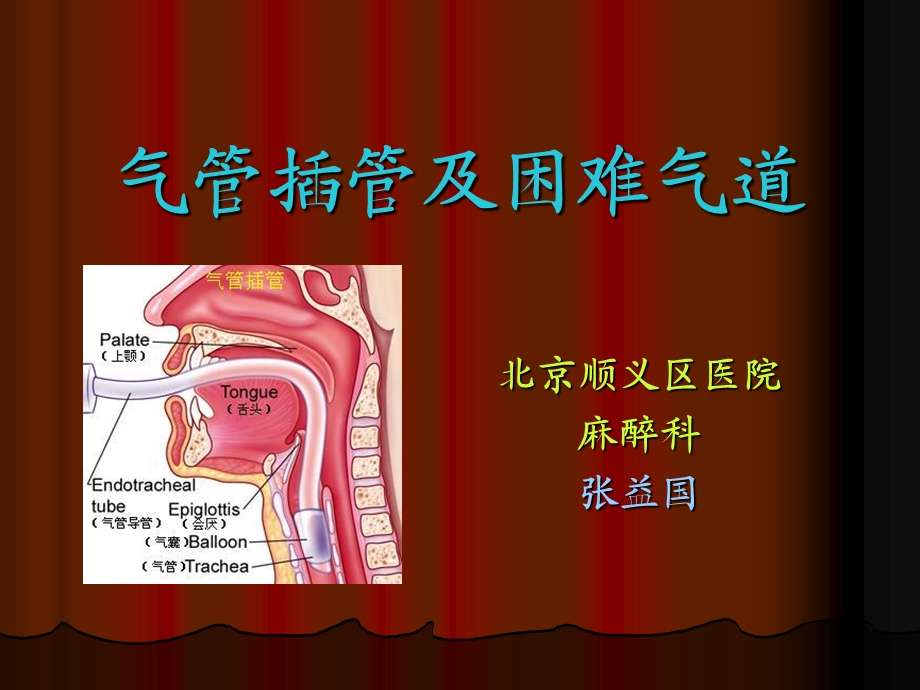 气管插管技术名师编辑PPT课件.ppt_第1页