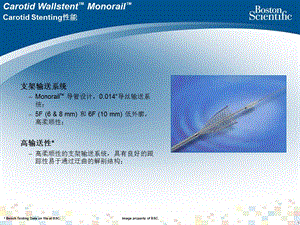 劲动脉支架Carotid wallstent课件精选文档.ppt