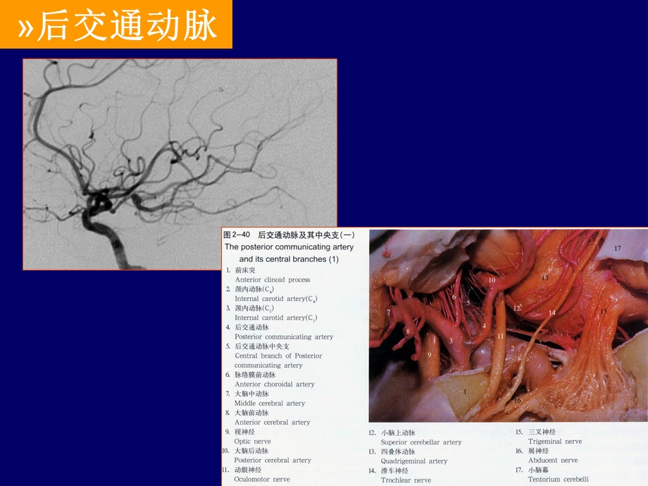 丘脑底节区脑血管解剖PPT文档.ppt_第3页