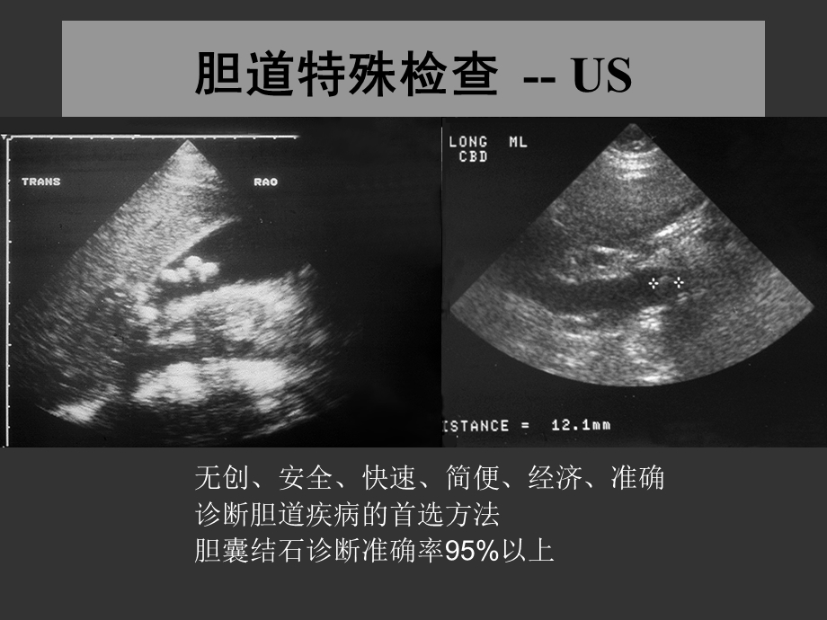 上海交大外科学胆道疾病ppt课件精选文档.ppt_第2页