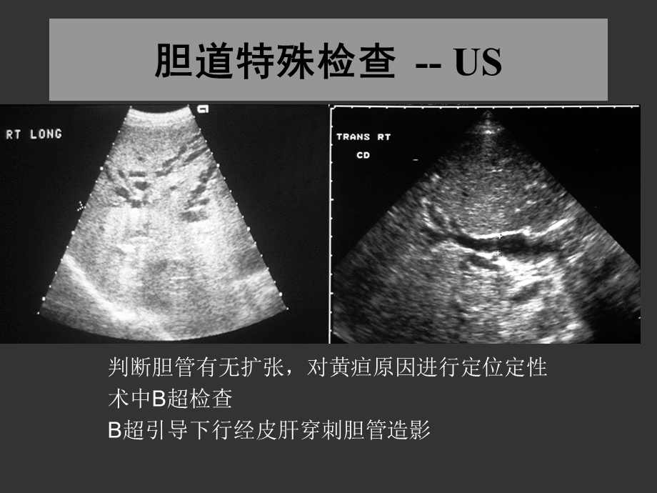 上海交大外科学胆道疾病ppt课件精选文档.ppt_第3页