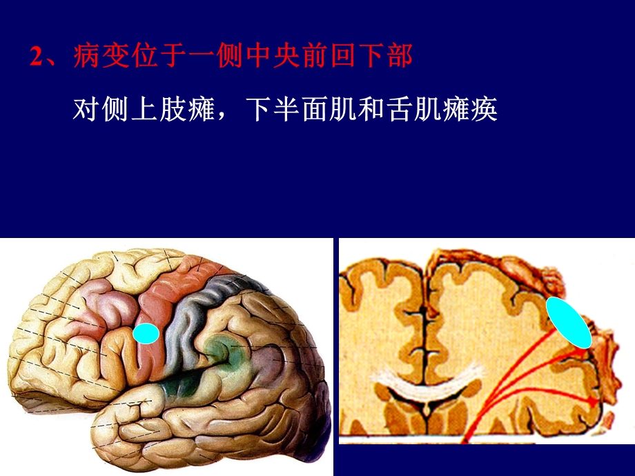 临床神经解剖3文档资料.ppt_第3页