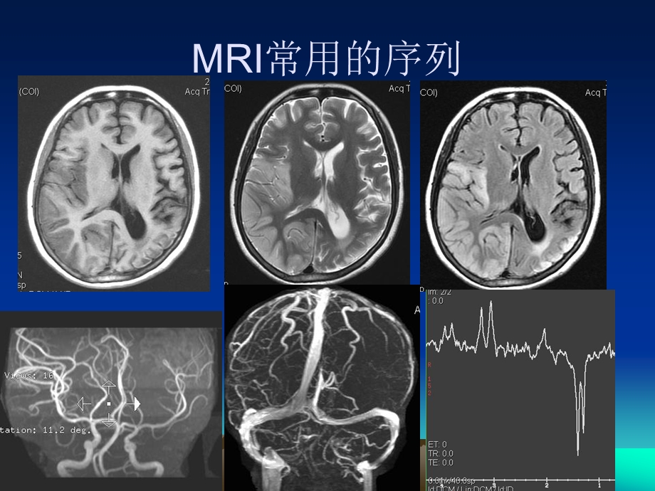 头颅MRI断层解剖名师编辑PPT课件.ppt_第2页