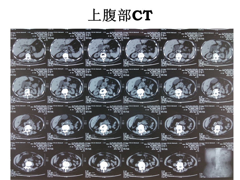 病例讨论PPT课件文档资料.pptx_第3页