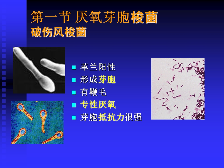 第十八章厌氧性细菌文档资料.ppt_第2页