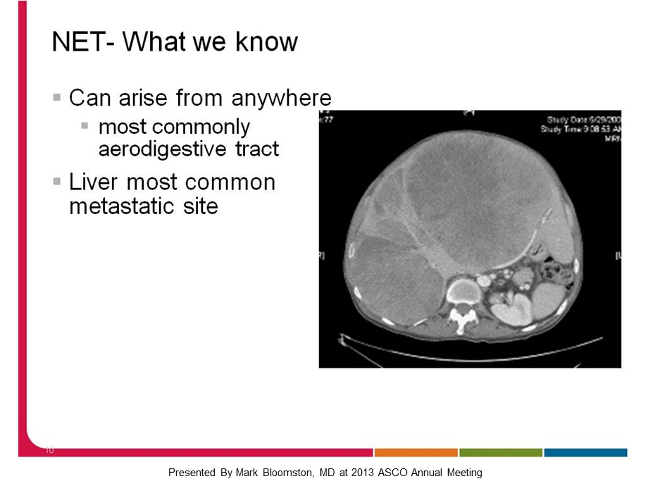 最新：医学NET肝脏局部治疗文档资料.ppt_第2页