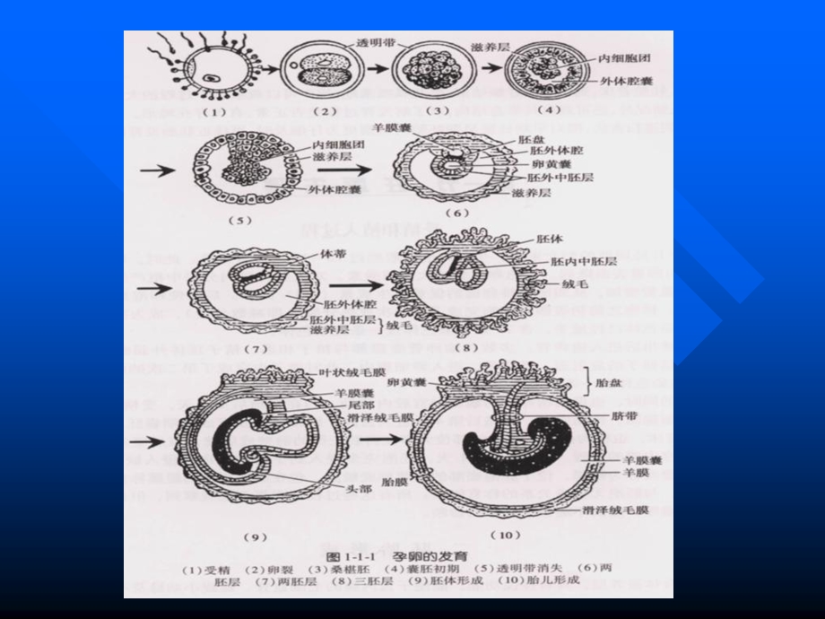 产科超声显像精选文档.ppt_第3页