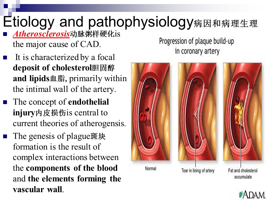 最新内科护理学课件 英语 考试资料CoronaryArteryDiseasePPT文档.ppt_第2页