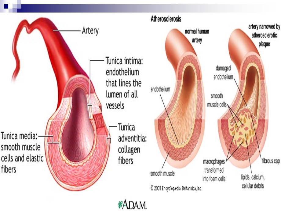 最新内科护理学课件 英语 考试资料CoronaryArteryDiseasePPT文档.ppt_第3页