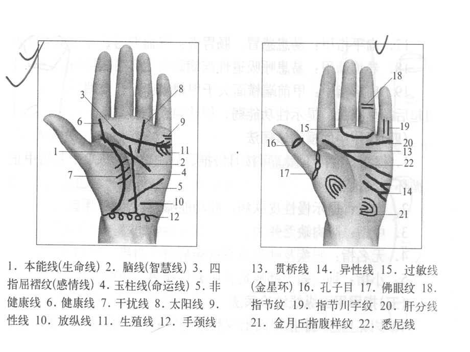 最新：中医美容系程——手诊文档资料.ppt_第3页