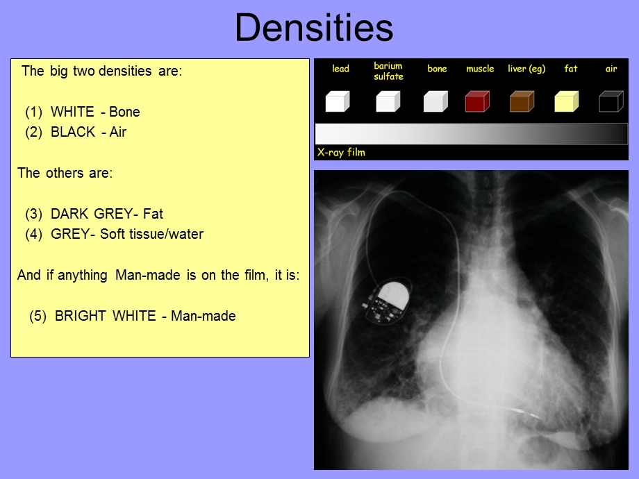 最新：The Chest XRay：胸部X光检查文档资料.ppt_第3页