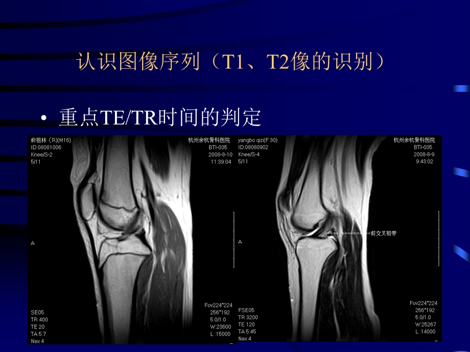 最新：骨关节病变mr诊断ppt课件文档资料.ppt_第2页