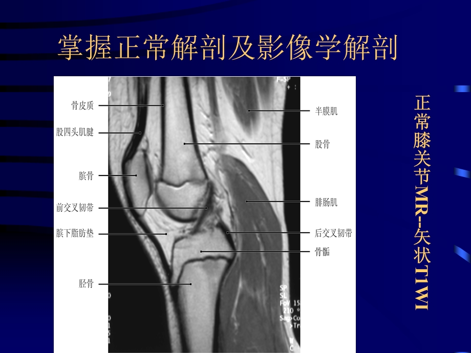 最新：骨关节病变mr诊断ppt课件文档资料.ppt_第3页