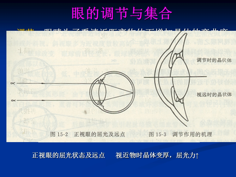 屈光不正病人及老视护理精选文档.ppt_第3页