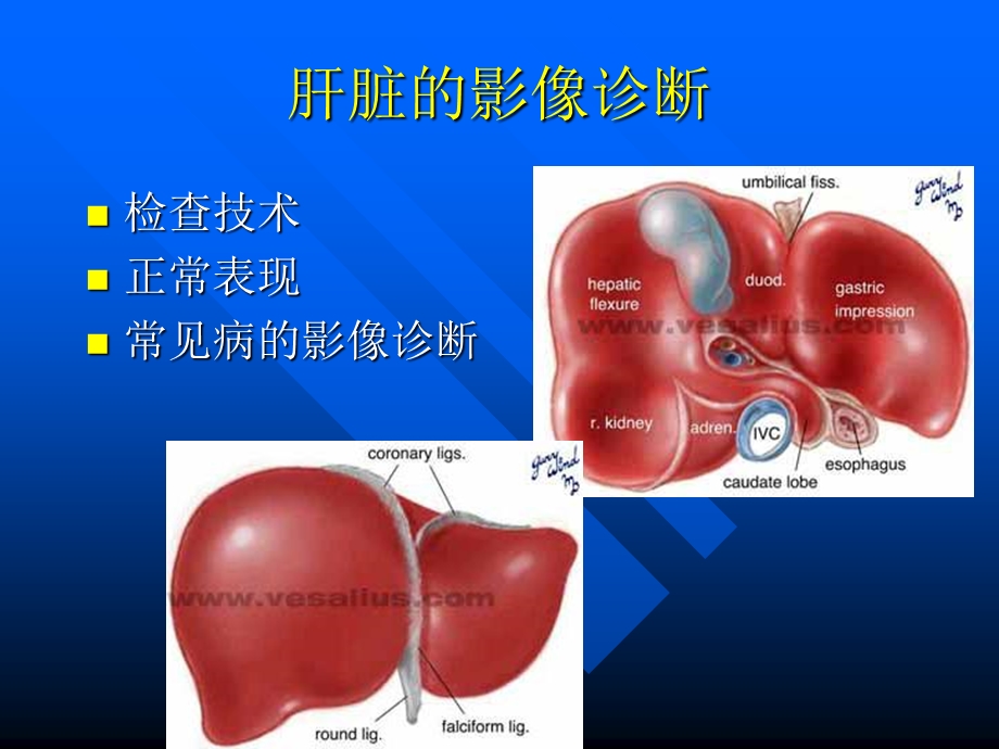 最新上腹部ct与mri诊断详解PPT文档.ppt_第1页