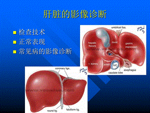 最新上腹部ct与mri诊断详解PPT文档.ppt