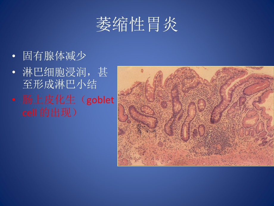 最新病理学 切片 实习 四川大学PPT文档.pptx_第3页