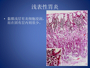 最新病理学 切片 实习 四川大学PPT文档.pptx