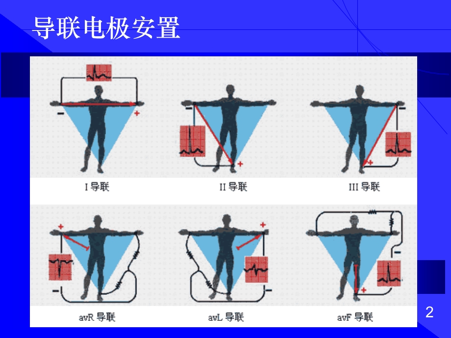 最新心电图阅读方法PPT文档.ppt_第1页