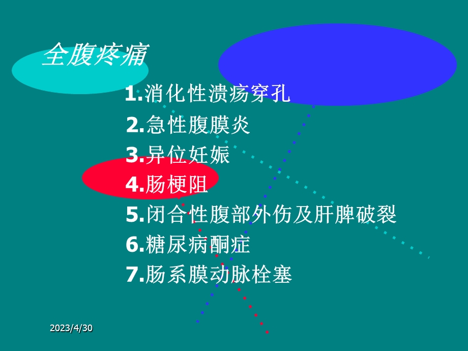 全腹疼痛腹痛的鉴别诊断精选文档.ppt_第3页