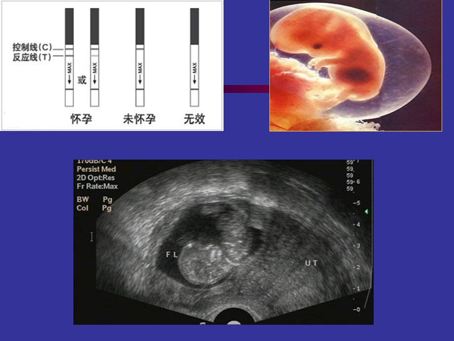 妊娠病总论上传PPT文档.ppt_第3页