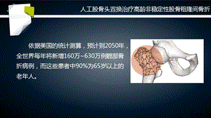 最新：人工股骨头置换治疗高龄非稳定性股骨粗隆间骨折文档资料.ppt