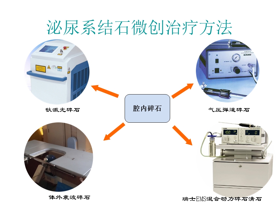 最新：简析泌尿系结石微创治疗澧县人民医院ppt课件文档资料.ppt_第3页