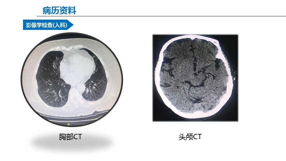 机械通气患者的早期康复文档资料.pptx_第3页