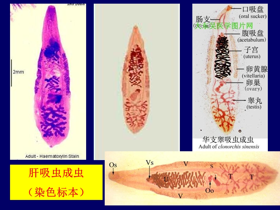 48章吸2肝、姜吸PPT课件.ppt_第2页