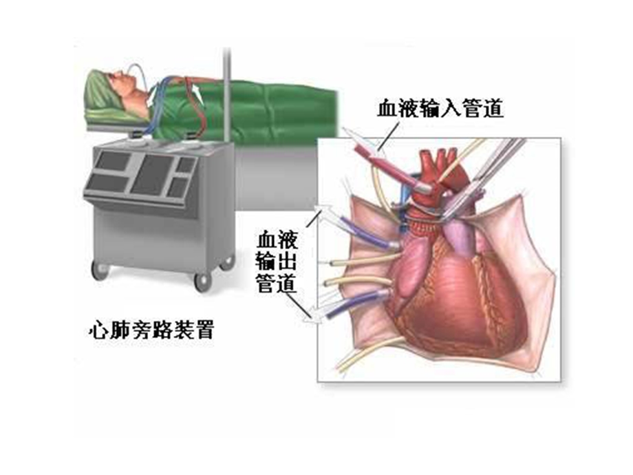 最新病理生理学网络课件第13章缺血再灌损伤课件PPT文档.ppt_第2页