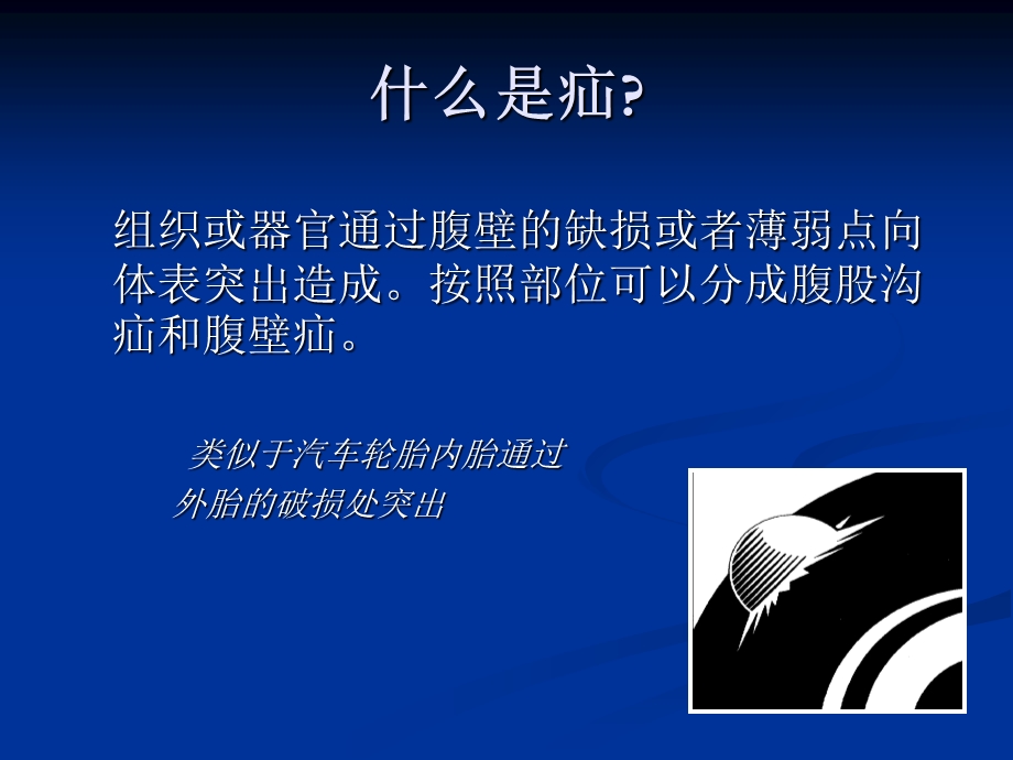 外科学课腹外疝PPT课件.ppt_第3页