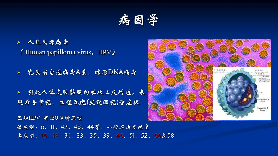 宫颈癌贾朝阳精选文档.ppt_第2页