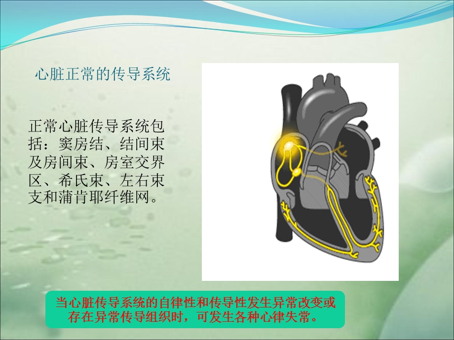 最新心脏起搏器植入术围术期护理ppt课件PPT文档.ppt_第3页