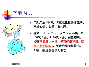 最新：产后出血ppt课件文档资料.ppt