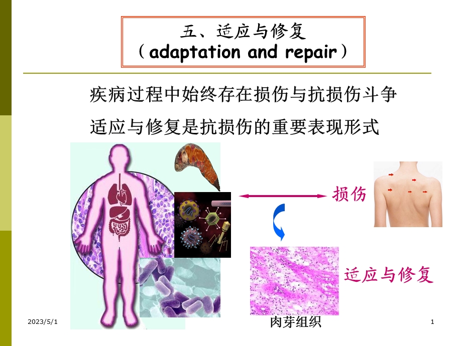 最新：病理学(四)文档资料.ppt_第1页