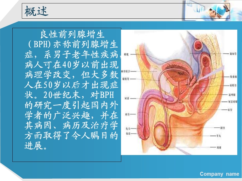 前列腺增生症肖龙飞精选文档.ppt_第1页