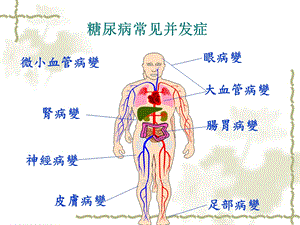 宋主任糖尿病神经并发症PPT文档资料.ppt